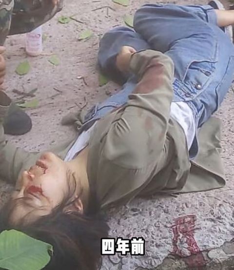 王暖暖全身17處粉碎性骨折，並失去腹中胎兒，但她最終保住了性命。圖/取自影片