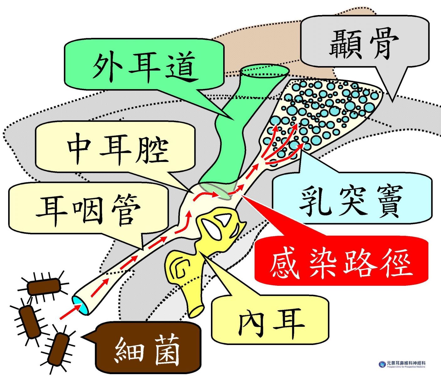 細菌感染途徑。圖/元景耳鼻喉科神經科診所提供