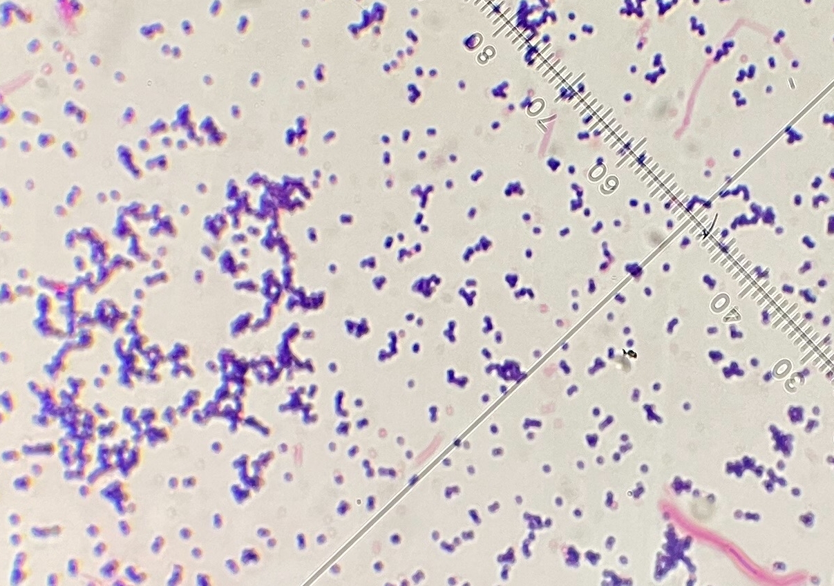 致病之山羊葡萄球菌在顯微鏡下的樣子。圖/優品醫事檢驗所提供