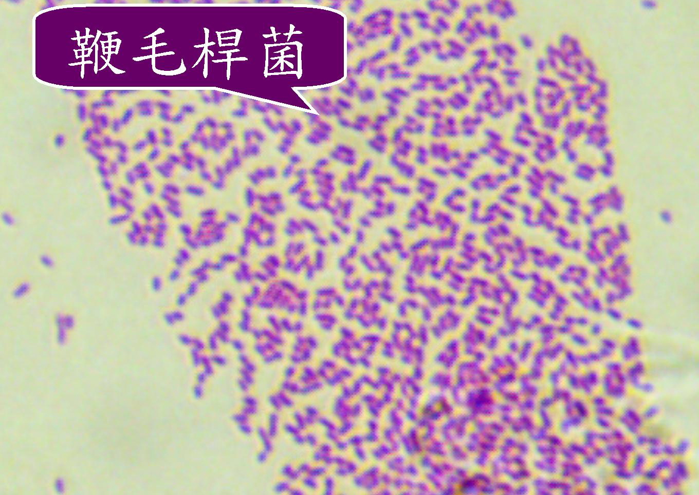 顯微鏡下，木糖氧化無色桿菌。 圖/優品醫事檢驗所提供