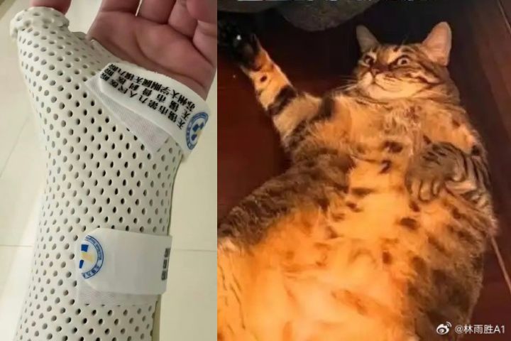 胖寵物的風險　被貓「枕」到骨折？7.5公斤肥貓壓傷主人