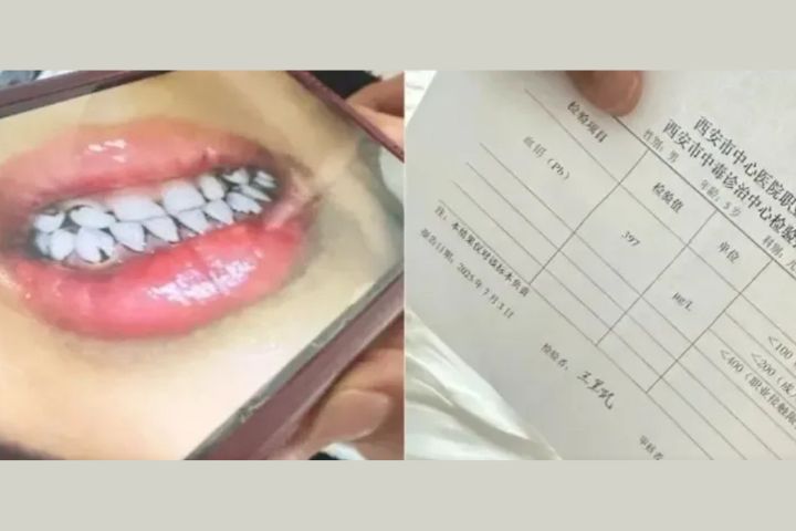 【有片】彩繪顏料變食材！甘肅幼兒園食品含鉛超標2000倍 233人中毒 8人刑拘