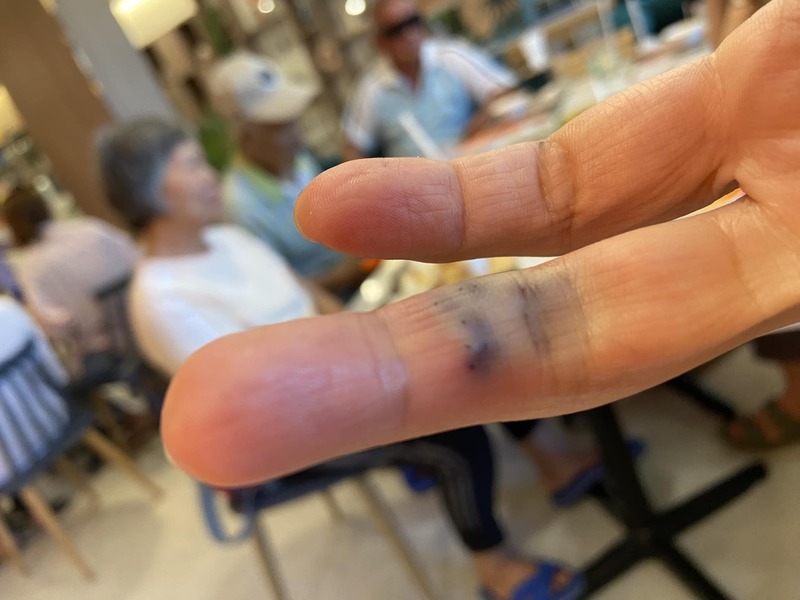 琉球海域的海膽不斷增生，侵蝕礁岩，還有遊客在浮潛時遭刺傷。圖/中央社