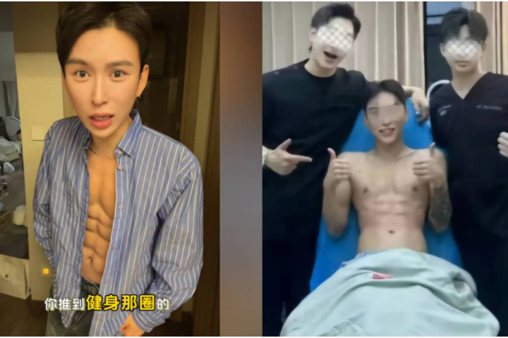 大陸首例「玻尿酸八塊腹肌」　網紅花1700萬台幣挑戰極限體態