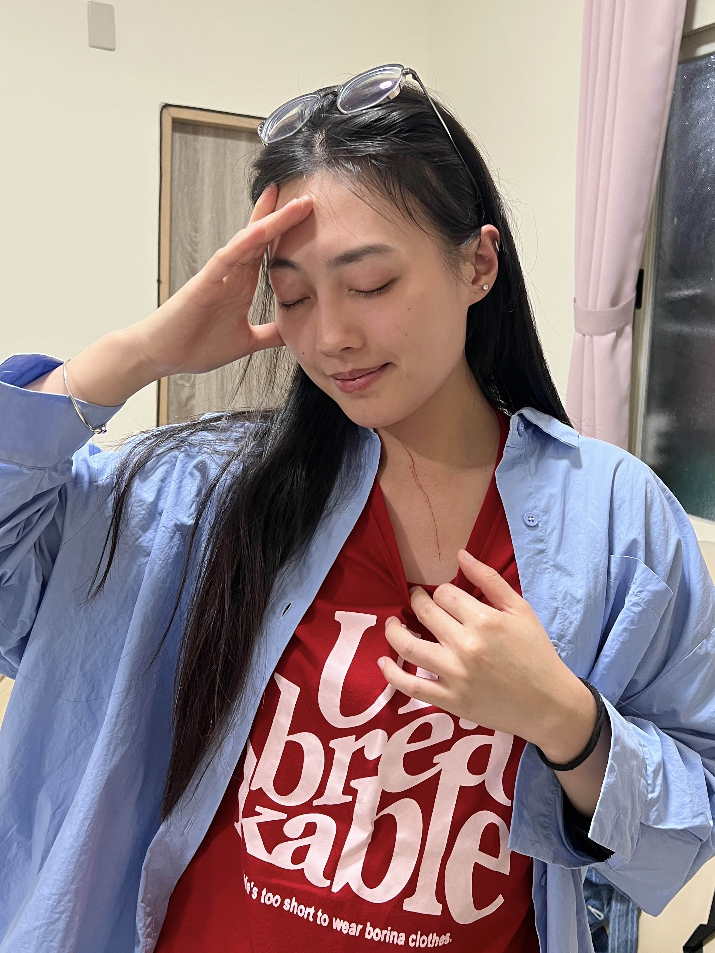 琟娜胸口被小花抓出血痕。圖/谷優娛樂提供