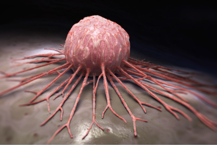 日本科學家突破！新型細菌療法「AUN」　或改寫癌症治療規則