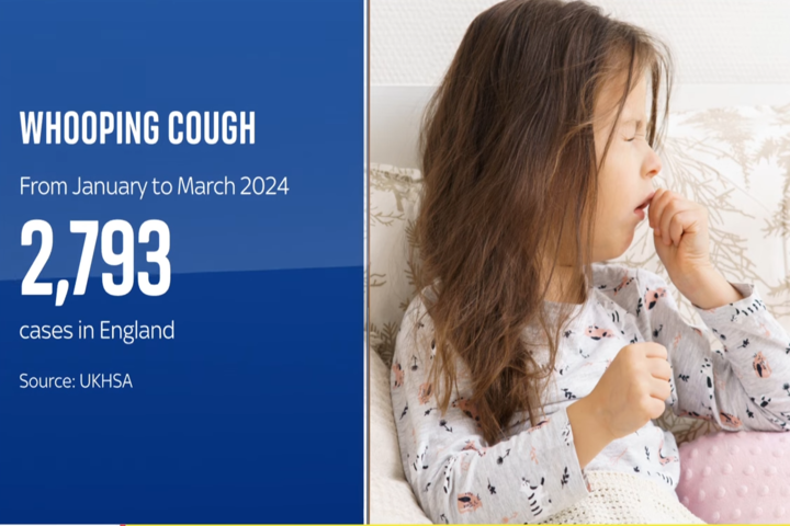 英國面臨40年來最嚴重百日咳疫情　已逾8千確診5名嬰兒死亡