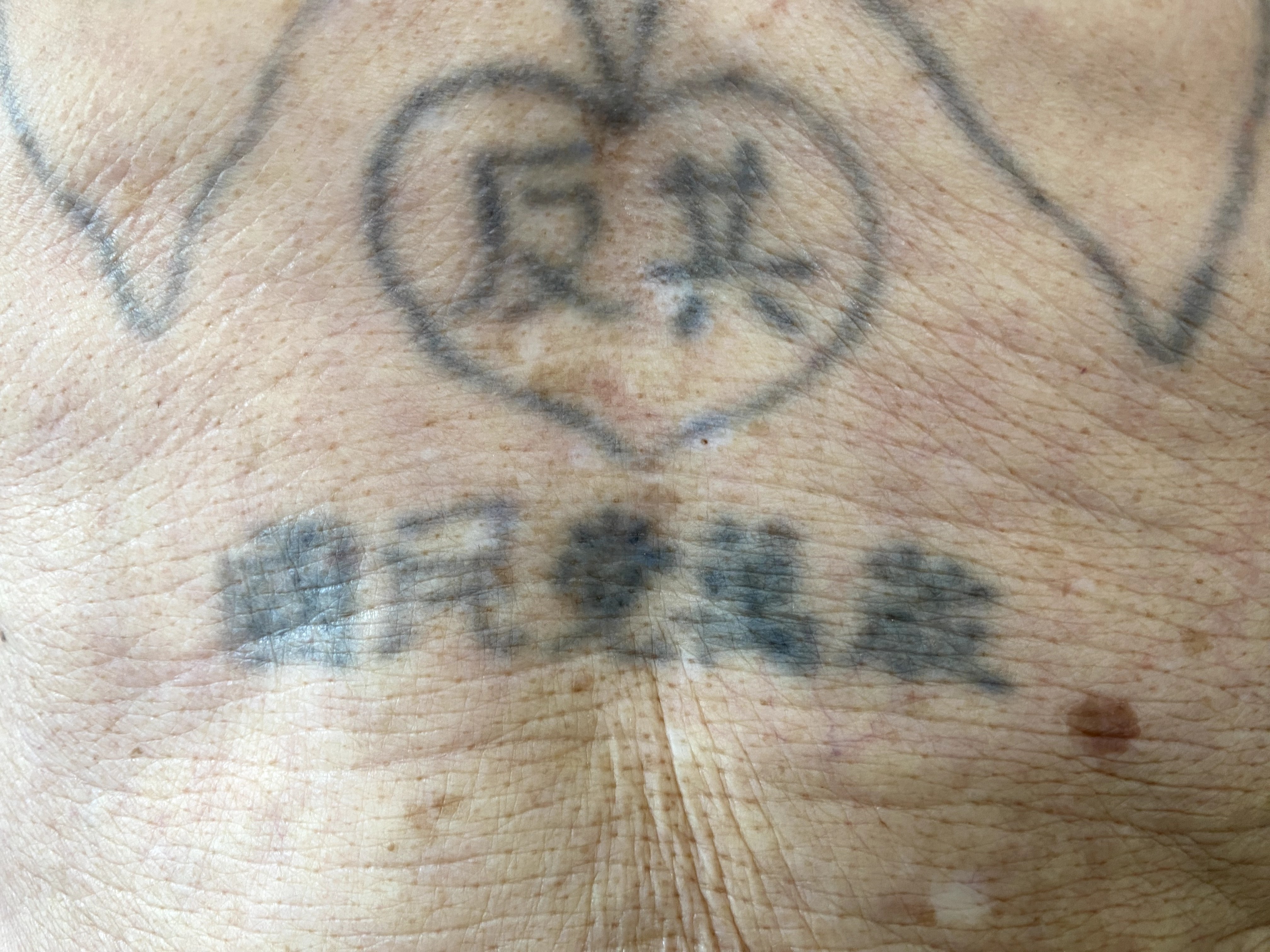 卜占才被關押戰俘營,身上遭刺滿反共圖騰及標語。圖/搶救遷台歷史記憶庫提供
