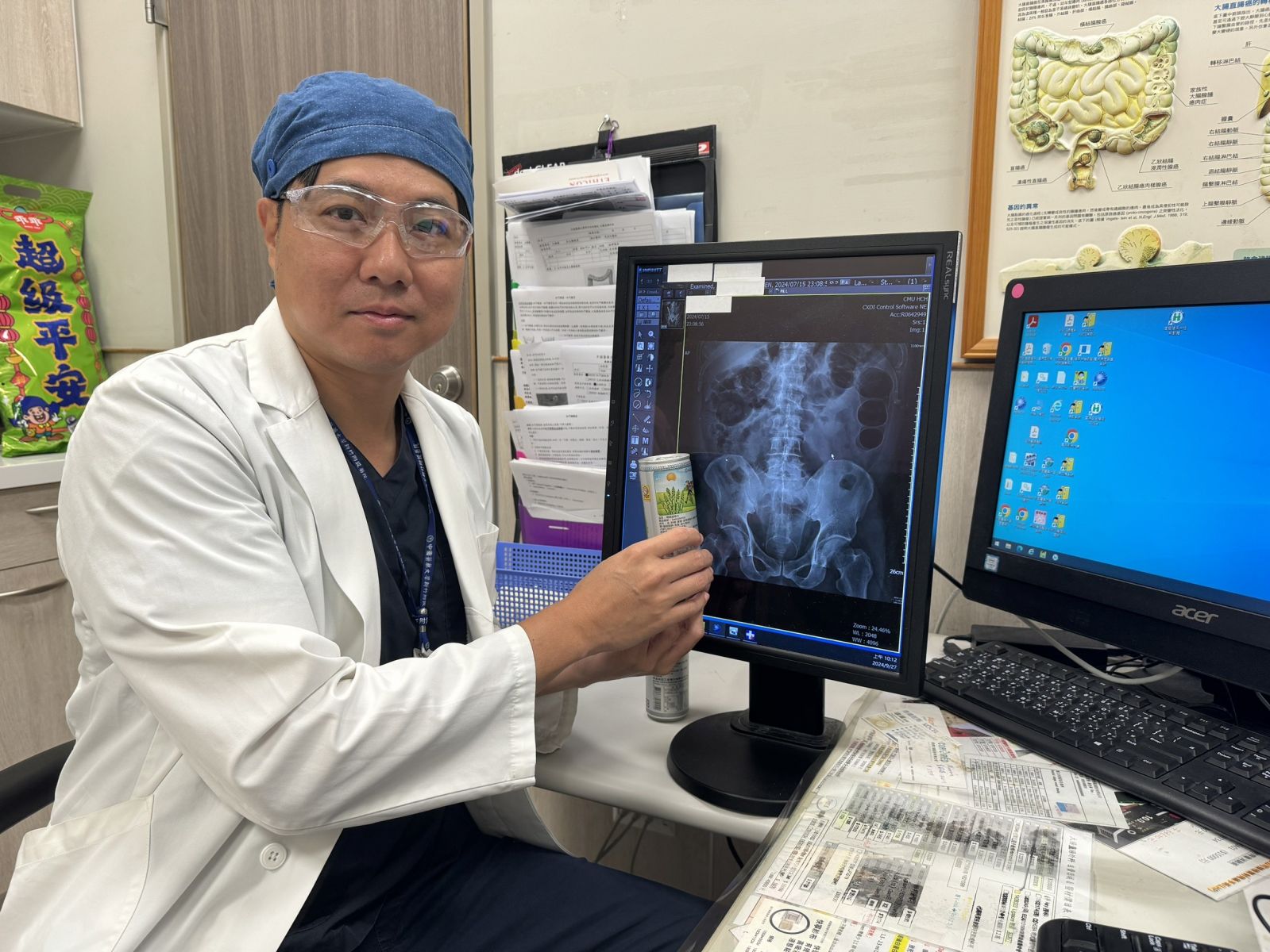 大腸直腸外科主任邵彥誠成功將肛門異物取出。圖/中醫大新竹醫院提供